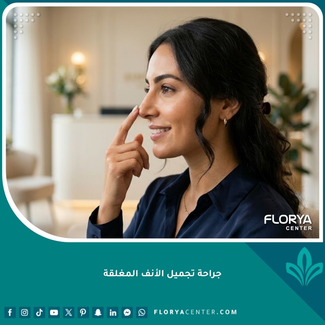 سيدة تبتسم بثقة بعد إجراء جراحة تجميل الأنف المغلقة بنجاح للحصول على تعديلات بسيطة وبدون ندبات خارجية.