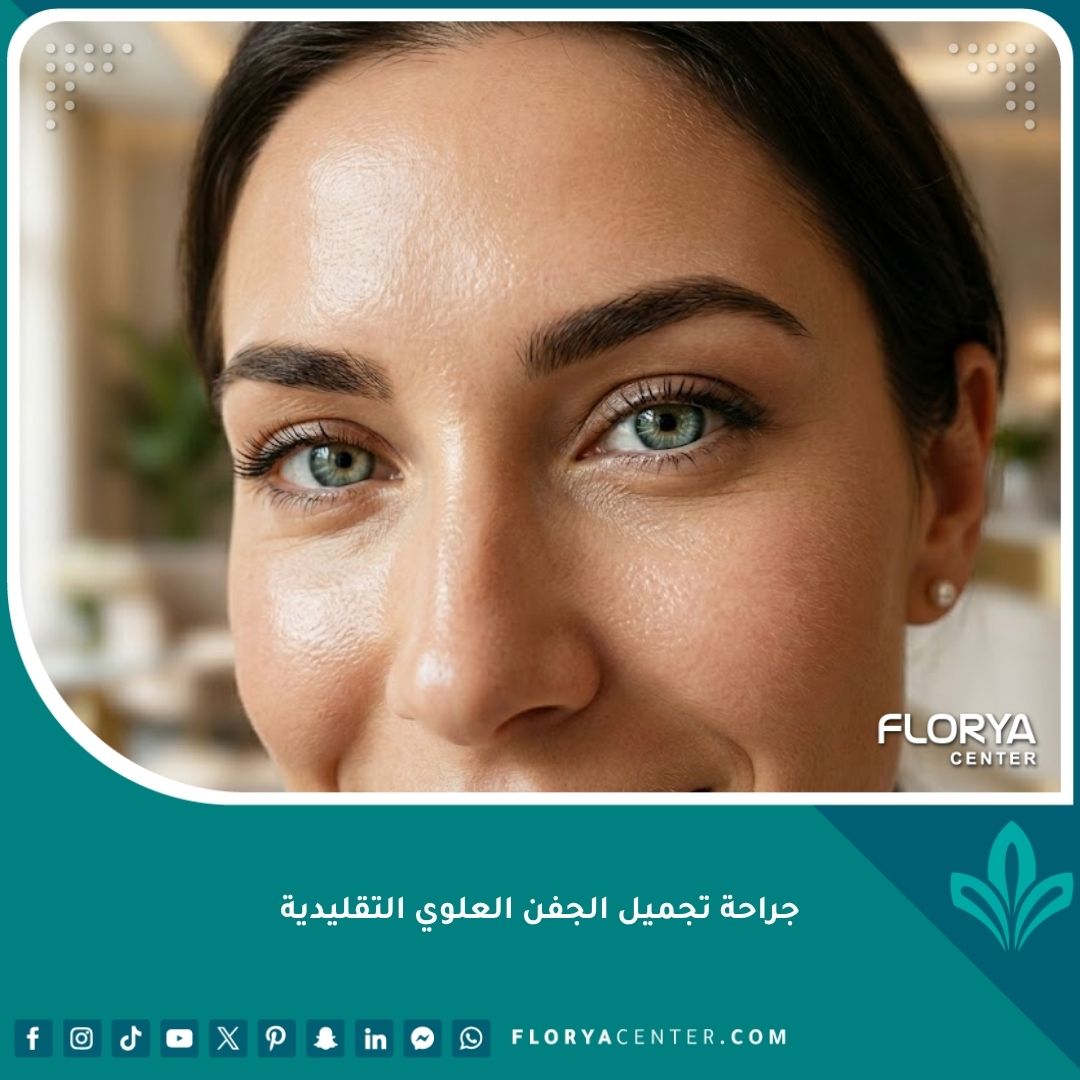 صورة مقربة تبرز جمال وإشراقة العيون بعد جراحة تجميل الجفن العلوي التقليدية للحصول على مظهر شاب وطبيعي.