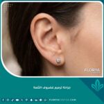 صورة مقربة وواقعية تبرز تناسق وجمال الأذن بعد جراحة ترميم غضروف الثلمة بنجاح.