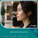 صورة جانبية لامرأة تظهر الزاوية الأنفية الشفوية المثالية بعد عملية تجميل الأنف للحصول على مظهر جذاب.