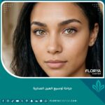 صورة مقربة تبرز جمال العيون وتناسقها المثالي بعد إجراء جراحة توسيع العين المدارية التجميلية.