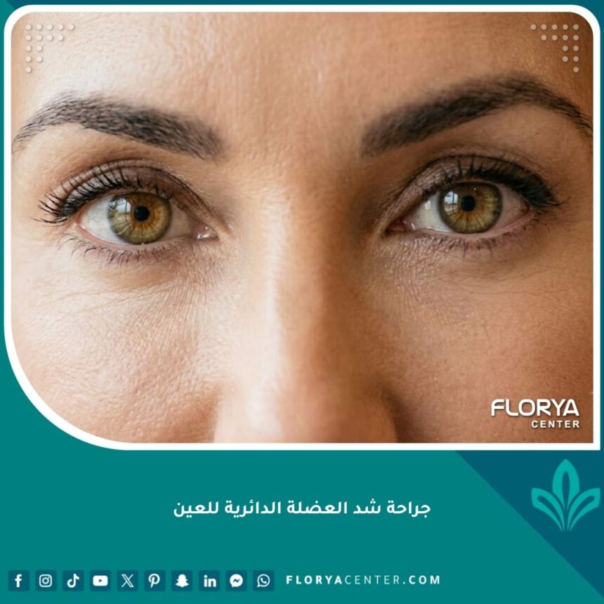 صورة مقربة تبرز نتائج جراحة شد العضلة الدائرية للعين وعلاج التجاعيد العميقة واستعادة شباب الوجه.
