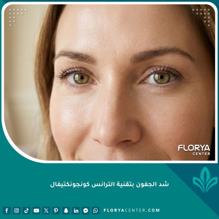صورة مقربة تظهر جمال وشباب العينين والنتائج المثالية لعملية شد الجفون بتقنية الترانس كونجونكتيفال بدون ندبات.