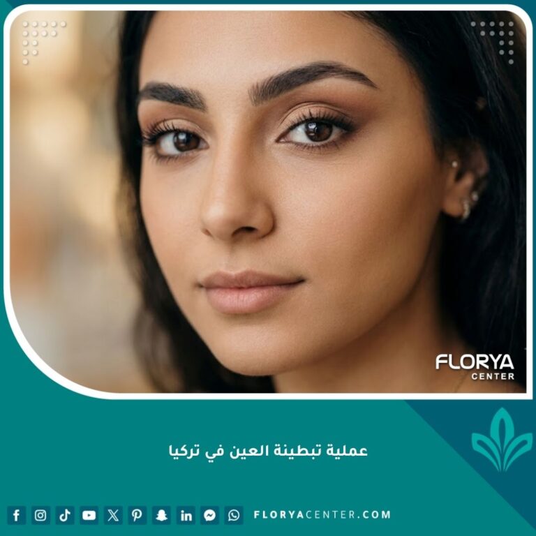 صورة مقربة تبرز جمال وجاذبية العين بعد نجاح عملية تبطينة العين في تركيا وإبراز الجفن المتحرك.