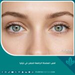 صورة مقربة لعينين بمظهر شاب ومشدود توضح نتائج عملية قص العضلة الرافعة للجفن في تركيا لعلاج الارتخاء.