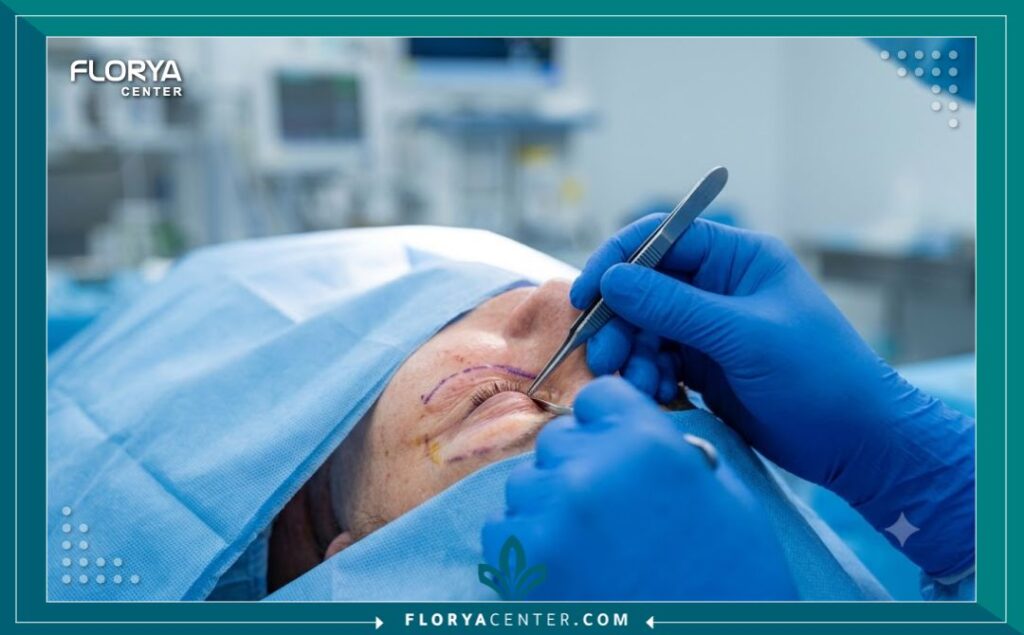 لقطة مقربة احترافية ومعقمة من داخل غرفة العمليات، تظهر يد جراح تجميل يرتدي قفازات وهو يقوم بدقة بعملية شد الجفن وإزالة الجلد الزائد في الجفون، مما يضمن أعلى معايير الجودة والتعقيم.