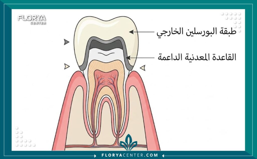 رسم تخطيطي تشريحي يوضح مكونات تاج البورسلين فوق المعدن وتركيب الأسنان الداخلي.