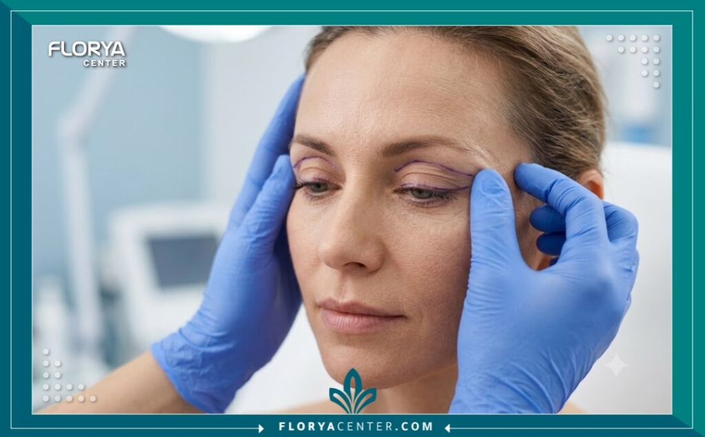 اسعار عمليات تجميل الجفون في تركيا 5 طبيب تجميل عيون مختص يقوم بتخطيط وفحص جفون المريضة قبل بدء عملية شد الأجفان لضمان أفضل النتائج الجمالية.
