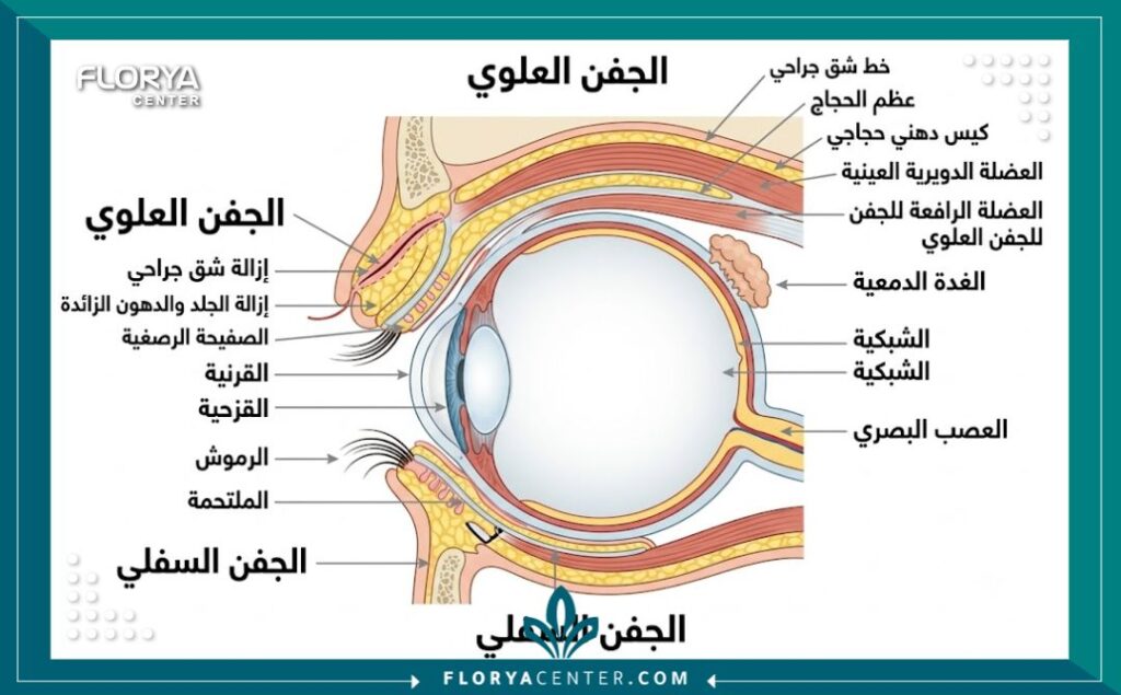 اسعار عمليات تجميل العيون في اسطنبول 2 مخطط توضيحي لعملية شد الجفون وتجميل العيون لمعرفة تفاصيل العملية