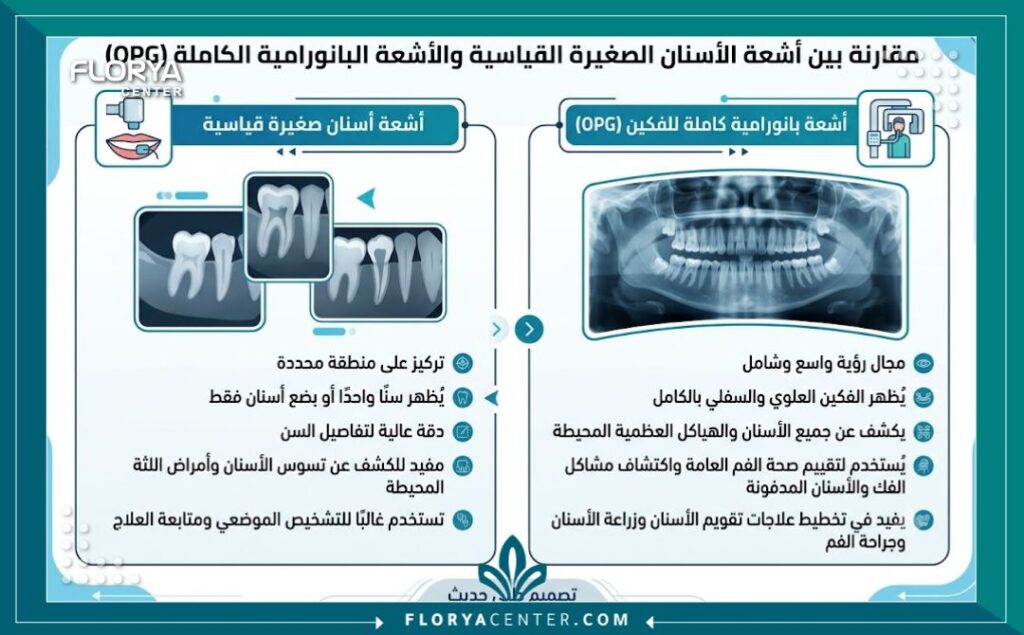 إنفوجرافيك يقارن بين الأشعة العادية واشعة بانوراما للاسنان في تركيا لبيان شمولية التشخيص للفكين بالكامل.