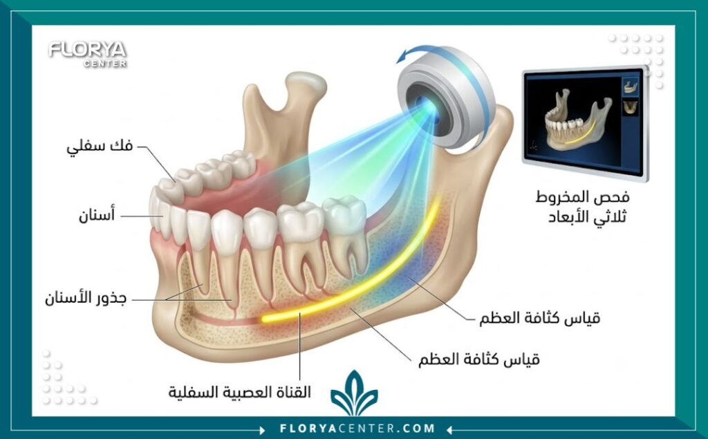 رسم توضيحي طبي يوضح تشريح الفك وكيفية عمل الأشعة المقطعية للأسنان CBCT بدقة عالية قبل الزراعة.