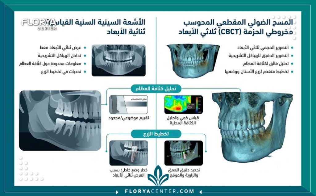 إنفوجرافيك يقارن بين الأشعة السينية العادية والأشعة المقطعية للأسنان ثلاثية الأبعاد لزراعة الأسنان في تركيا.