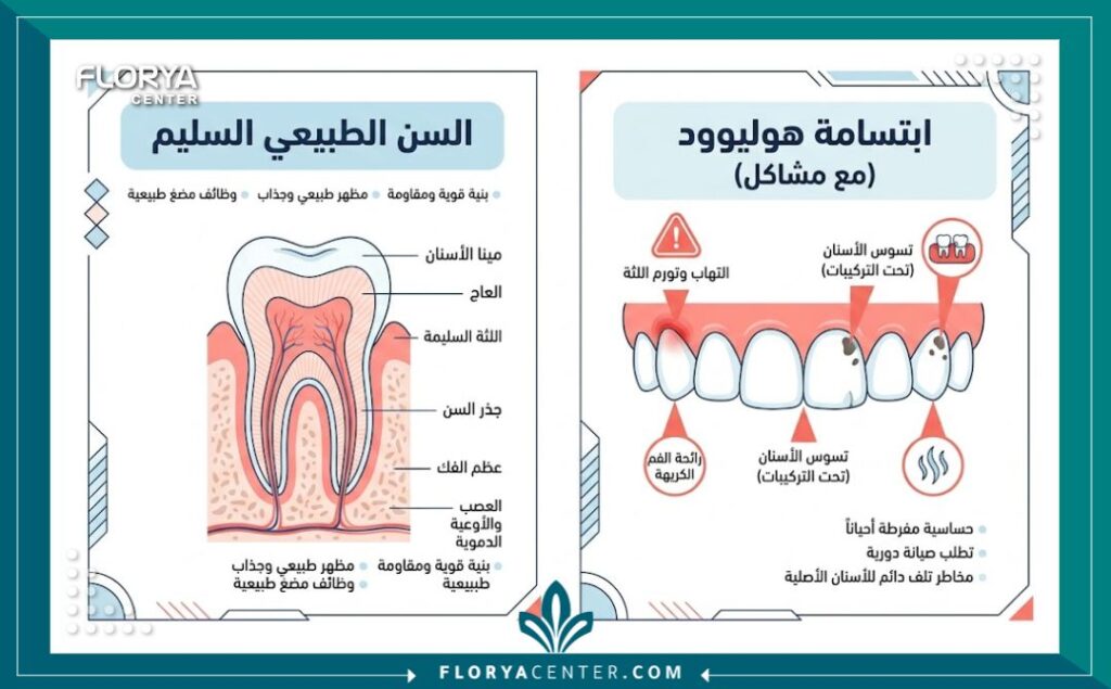 إنفوجرافيك يقارن بين الأسنان الطبيعية والآثار الجانبية المحتملة و اضرار ابتسامة هوليود 3D.