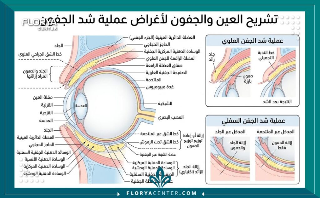 افضل دكتور تجميل جفون في اسطنبول 2 رسم توضيحي طبي دقيق لتشريح العين والجفون، يشرح خطوات عملية قص الأجفان وإزالة الدهون الزائدة في عيادات التجميل في تركيا.