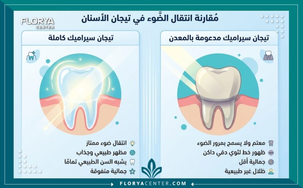 إنفوجرافيك يقارن بين التركيبات الخالية من المعدن والتيجان التقليدية من حيث شفافية الضوء والمظهر الطبيعي.