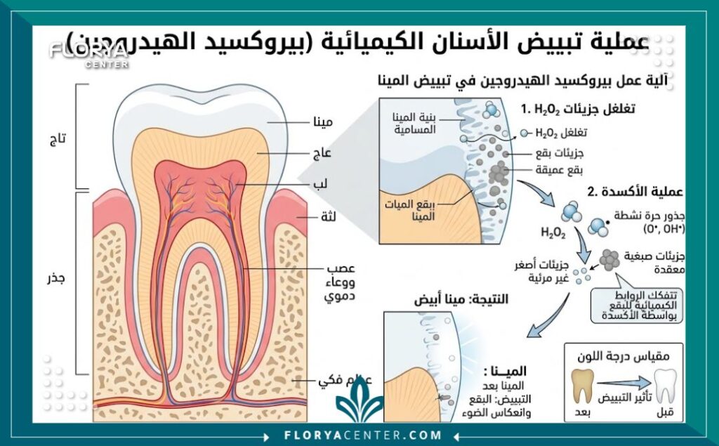 تبييض الاسنان الكيميائي 2 رسم توضيحي طبي لطبقات السن يوضح آلية عمل تبييض الاسنان الكيميائي واختراق مادة بيروكسيد الهيدروجين لطبقة المينا.