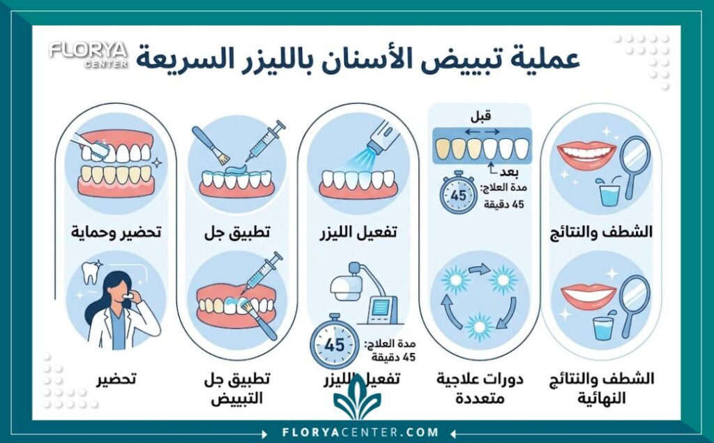 تبييض ليزر في تركيا 3 إنفوجرافيك يقارن درجات لون الأسنان قبل وبعد التبييض السريع بالليزر في العيادة.