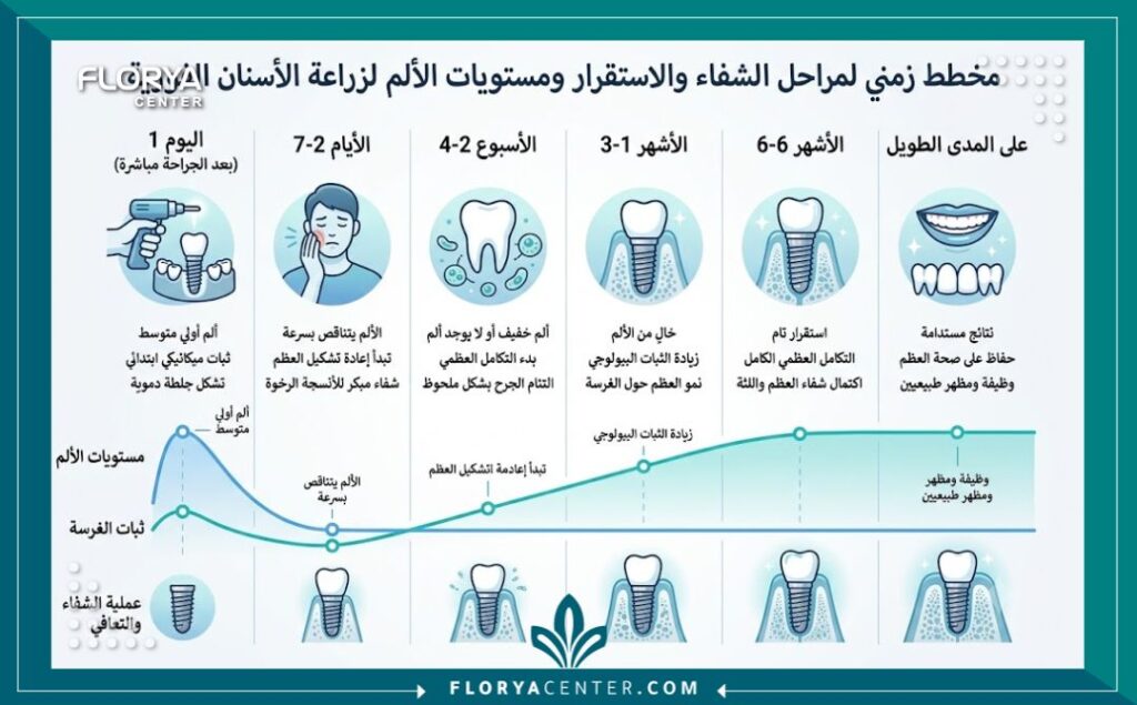 إنفوجرافيك يقارن مستويات الألم ومدة التعافي لضمان استقرار الزرعة في تجربتي مع زراعة الاسنان الفورية.