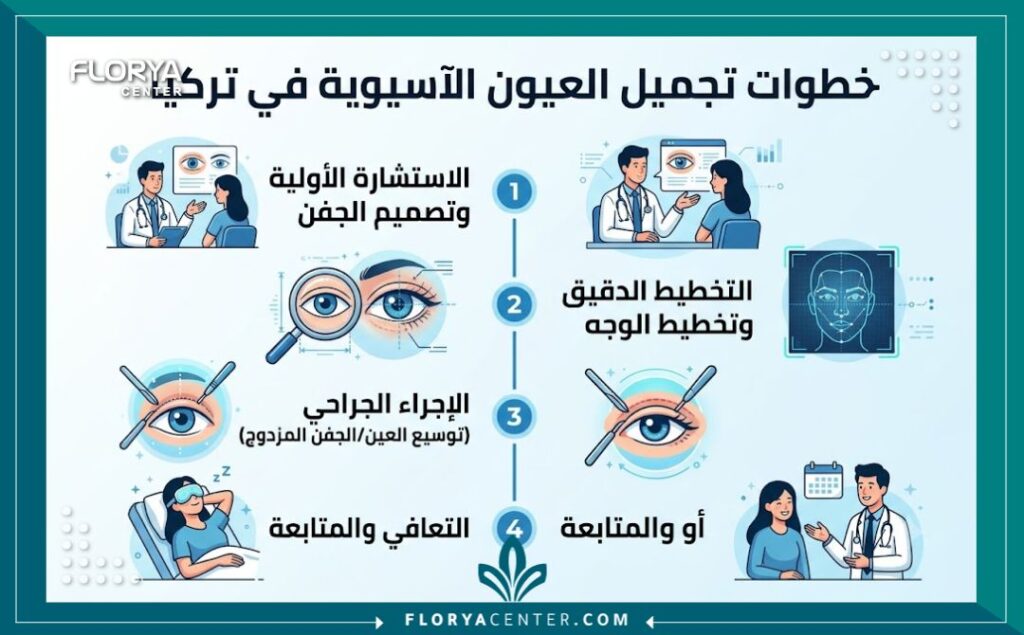 انفوجرافيك يوضح خطوات رحلة تجميل العيون الآسيوية في تركيا، من الاستشارة وحتى التعافي.