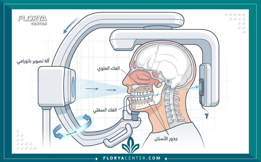 تكلفة اشعة البانوراما في تركيا 2 مخطط طبي توضيحي لكيفية عمل أشعة البانوراما للأسنان وتكلفة الفحص المبدئي للفكين