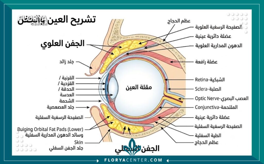 مخطط طبي يوضح تشريح الجفن العلوي والسفلي وأماكن تجمع الدهون التي يتم استهدافها في جراحة تجميل الجفون.