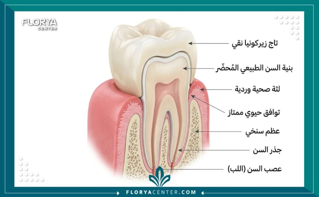 تلبيسة زيركون في تركيا 2 رسم توضيحي طبي يوضح تركيب تاج الزيركون على السن وتلائمه الحيوي الممتاز مع اللثة بدون أي حواف معدنية.