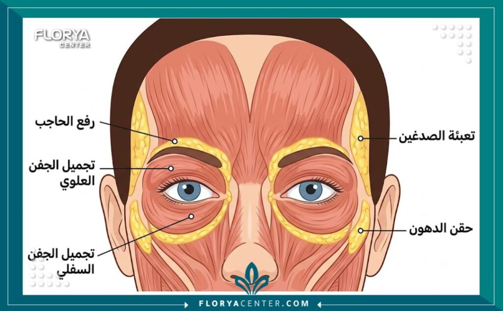 رسم تخطيطي طبي يُفصّل تشريح الوجه العلوي والمناطق المستهدفة في جراحة تجميل محيط العين الشاملة (الحواجب، الجفون، الصدغين) مع تسميات باللغة العربية