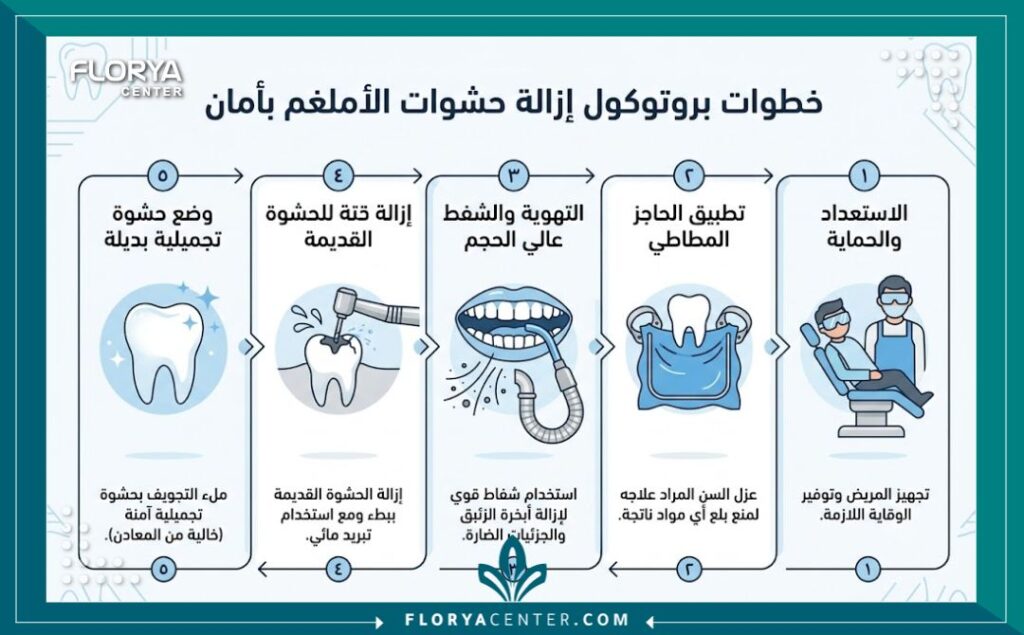 إنفوجرافيك يوضح خطوات الإزالة الآمنة لحشوات الاملغم في تركيا وتجنب التسمم بالزئبق في عيادات الأسنان.