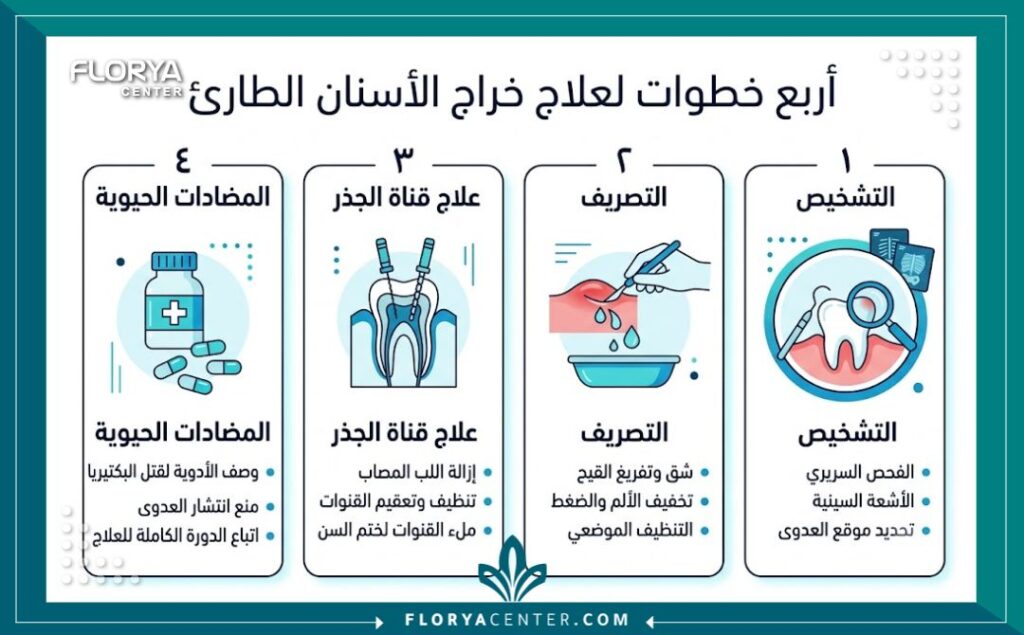 إنفوجرافيك يشرح خطوات علاج خراج الأسنان وفتح التجمع الصديدي وتنظيفه.