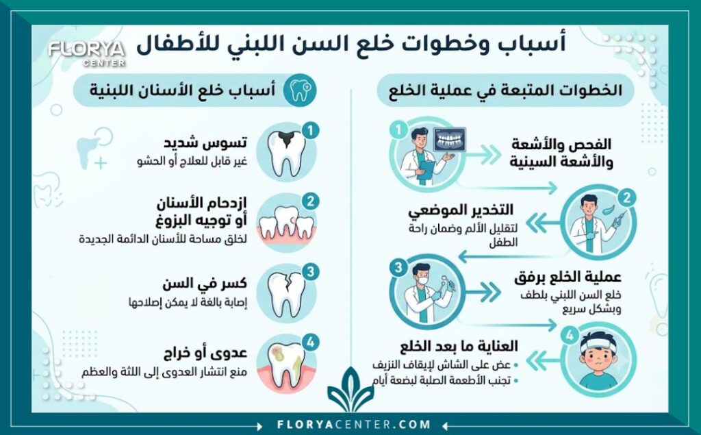 إنفوجرافيك يوضح أسباب وخطوات خلع الأسنان اللبنية للأطفال بدون ألم لضمان نمو الأسنان الدائمة.