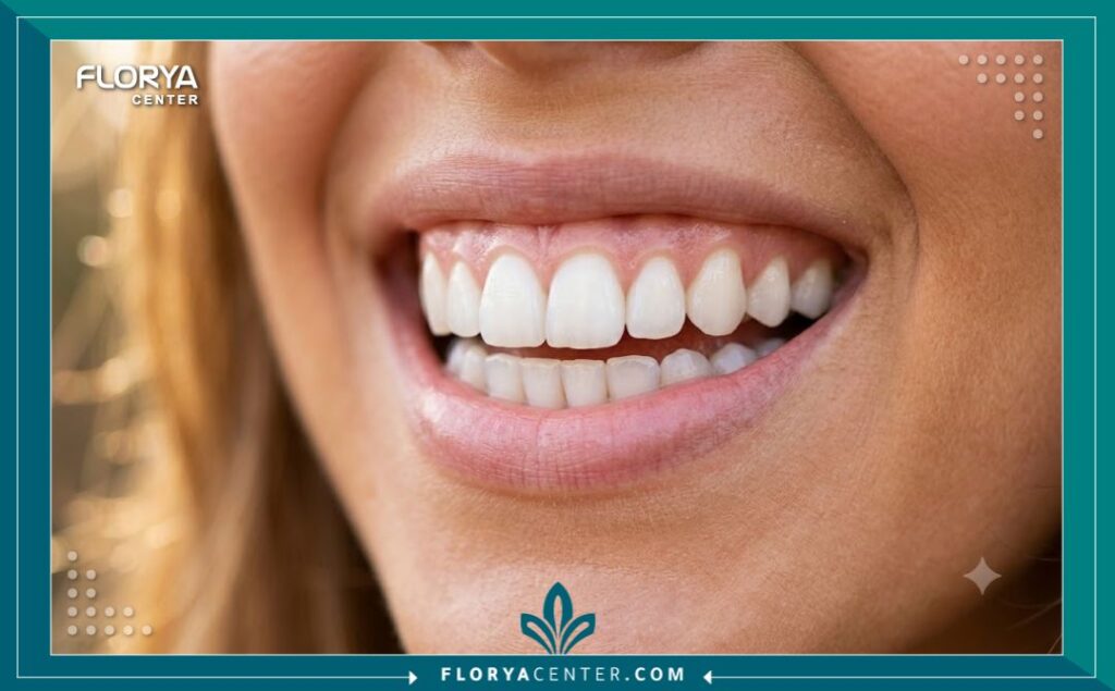 ابتسامة طبيعية وجذابة لامرأة بعد الحصول على تركيبات ودعامة الاسنان في تركيا التجميلية الناجحة.