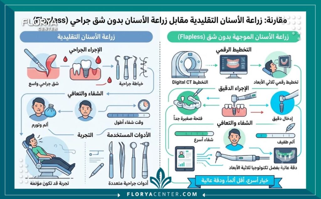 إنفوجرافيك يقارن بين زراعة الأسنان التقليدية وتقنية زراعة الاسنان بدون جراحة ومميزات التعافي السريع.