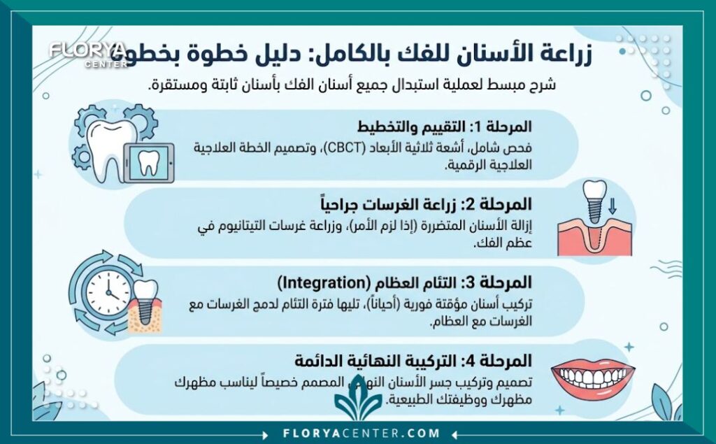 إنفوجرافيك يوضح خطوات ومميزات زراعة الاسنان All-on-4 لتعويض الفك الكامل.