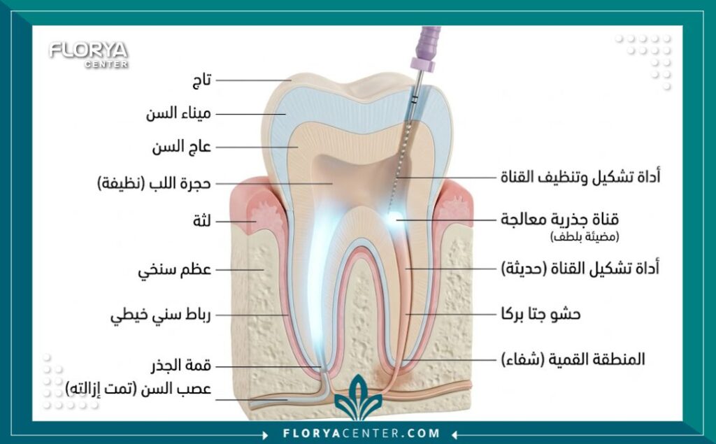 سحب العصب بدون الم في تركيا 2 رسم توضيحي طبي دقيق يشرح تشريح السن وخطوات سحب العصب بدون ألم باستخدام أحدث التقنيات.