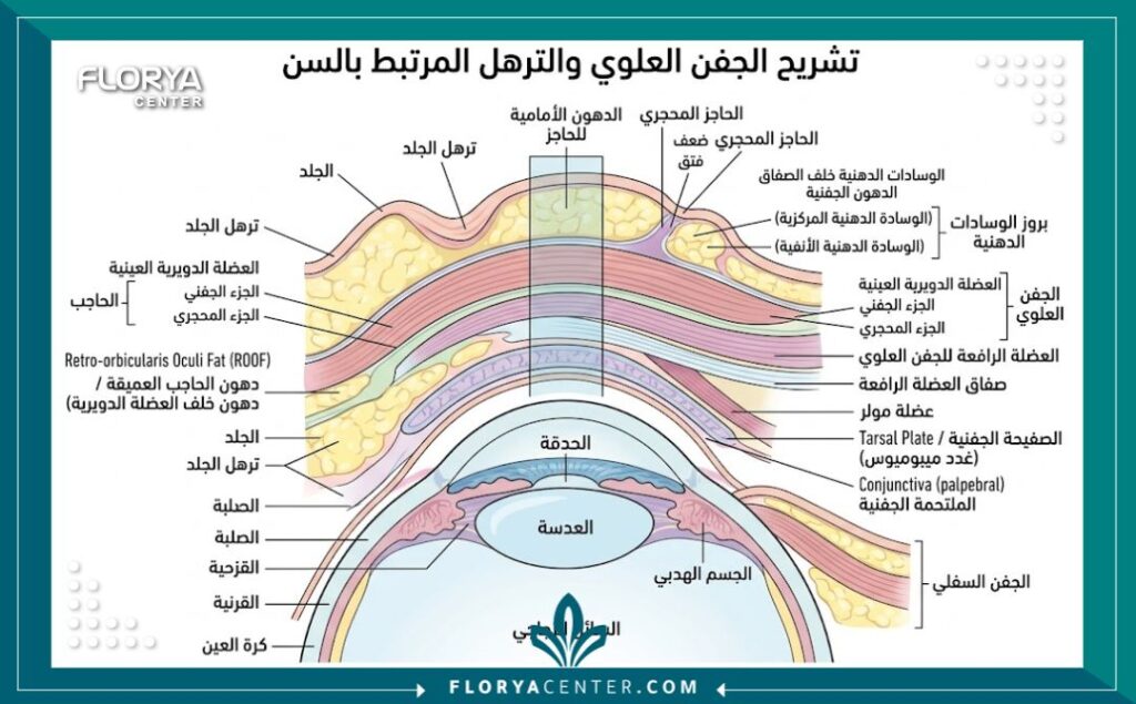 شد الجلد المترهل فوق العين 2 رسم توضيحي طبي دقيق يشرح تشريح الجفن العلوي، وتراكم الدهون، وأسباب ظهور الجلد المترهل فوق العين.