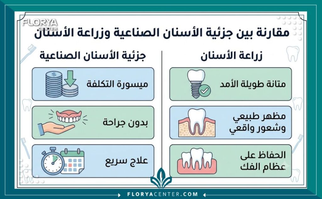 طقم اسنان جزئي في تركيا 3 إنفوجرافيك يقارن بين طقم الأسنان الجزئي وزراعة الأسنان يوضح مميزات التعويض المتحرك بدون جراحة.