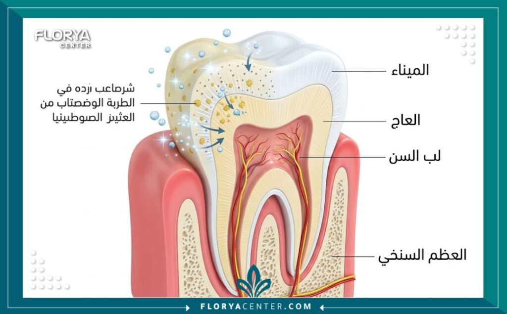 رسم توضيحي طبي لطبقات السن يوضح كيفية عمل التبييض الكيميائي لاختراق المينا وعلاج اصفرار الأسنان وتصبغاتها.
