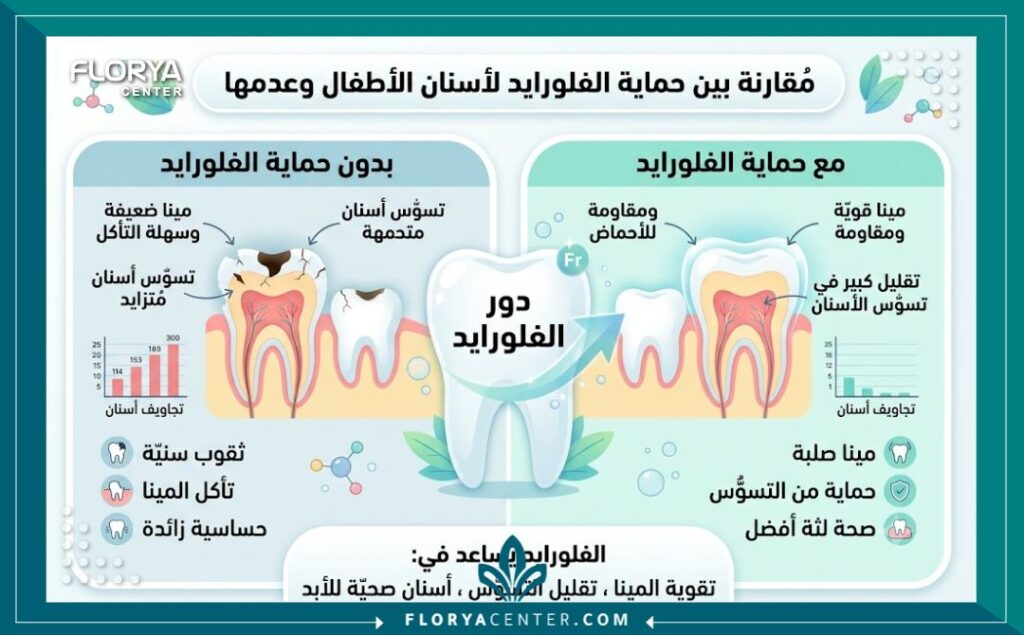 إنفوجرافيك يقارن بين الأسنان المعالجة بالفلورايد والأسنان غير المعالجة لبيان نسبة الوقاية من تسوس أسنان الأطفال.