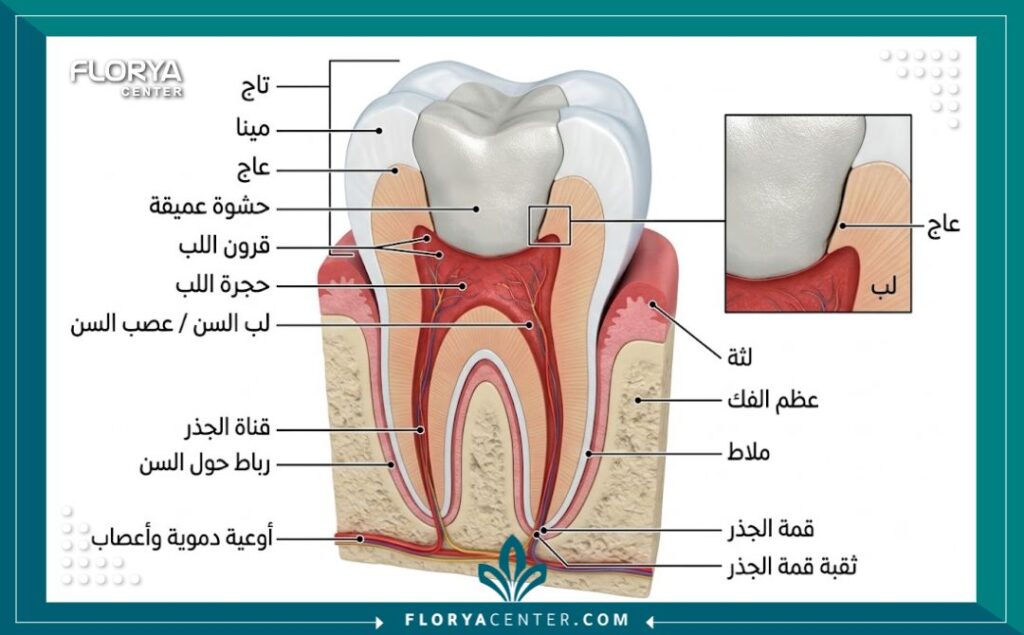 رسم توضيحي لتركيب السن يوضح وضع حشوة أسنان عميقة قريبة من العصب.