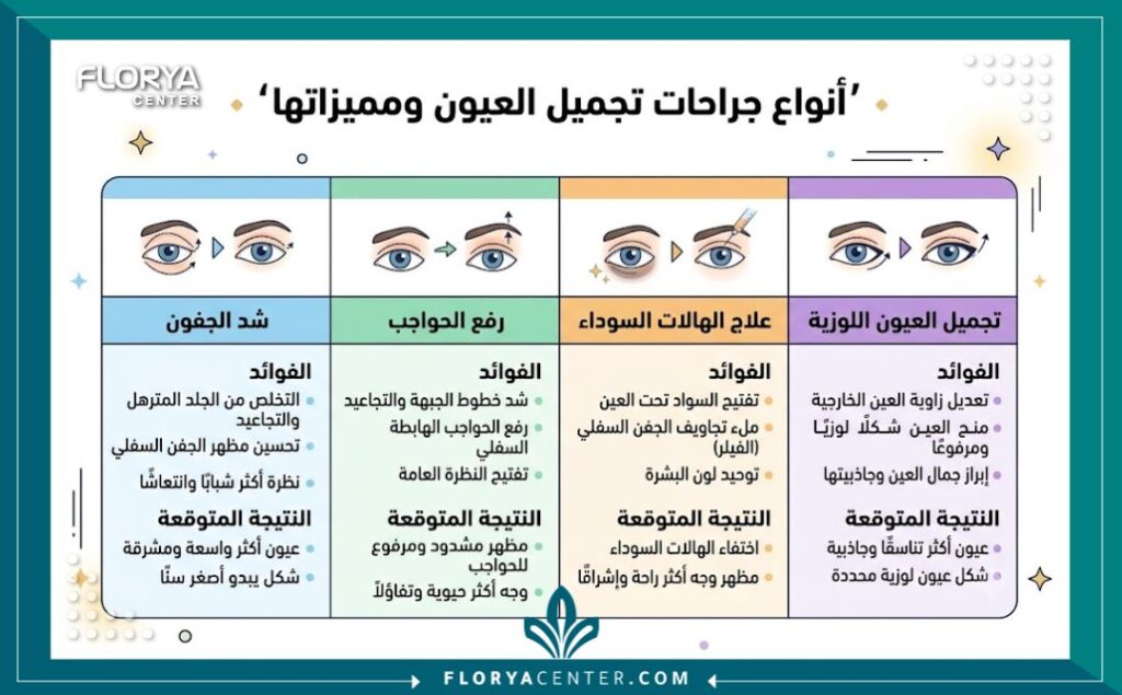 إنفوجرافيك طبي باللغة العربية يقارن بين أنواع عمليات تجميل العيون المختلفة في عيادات تجميل العيون في تركيا ومميزات كل نوع وفوائده المتوقعة للمريض.