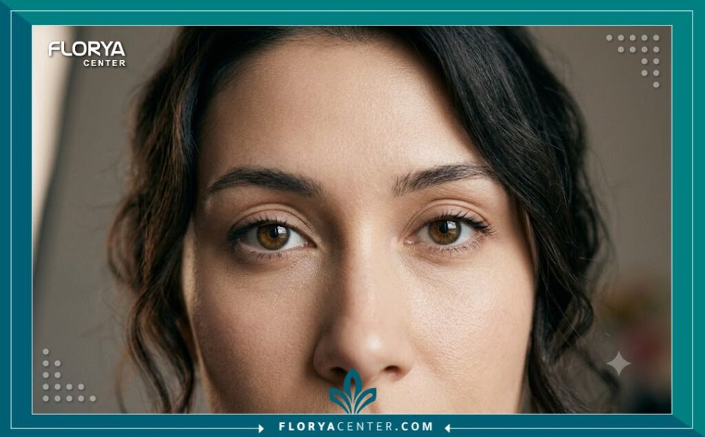 صورة تجميلية مقربة تركز على منطقة العين المتناظرة والبشرة المشدودة حولها، مبرزة النتائج الجمالية لعمليات تجميل الجفون.