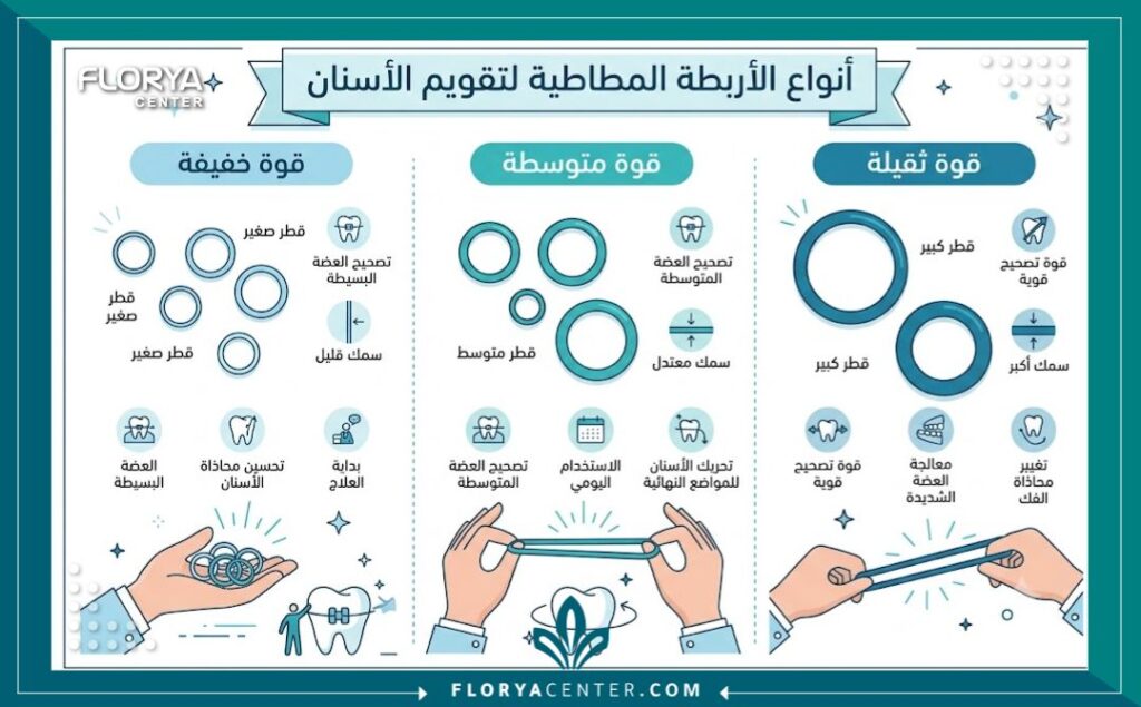 إنفوجرافيك يوضح أنواع وأحجام وقوة الشد المختلفة لـ مطاط التقويم في تركيا وتأثيرها على حركة الأسنان.