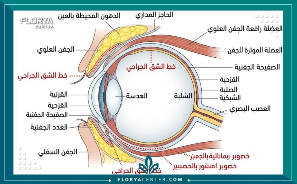 نصائح بعد عملية تجميل الجفون 2 رسم توضيحي طبي يبين تشريح العين والجفن، مع تحديد مناطق التدخل الجراحي والدهون المزالة أثناء عملية شد الجفون.