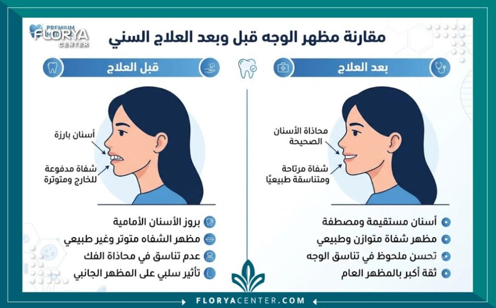 إنفوجرافيك يقارن شكل الوجه والبروفايل الجانبي والشفاه قبل وبعد تركيب تقويم الأسنان لعلاج بروز الفك وهل تقويم الاسنان يغير شكل الوجه.