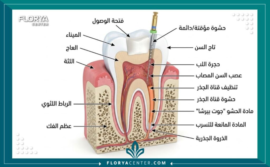 رسم توضيحي طبي دقيق يوضح تشريح السن وخطوات سحب العصب وعلاج الجذور للتخلص من الألم.
