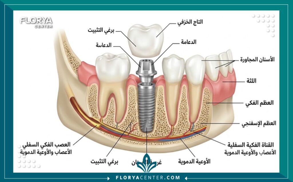 رسم توضيحي طبي يظهر تشريح ومكونات الاسنان السويسرية هي الافضل داخل عظم الفك بدقة عالية.