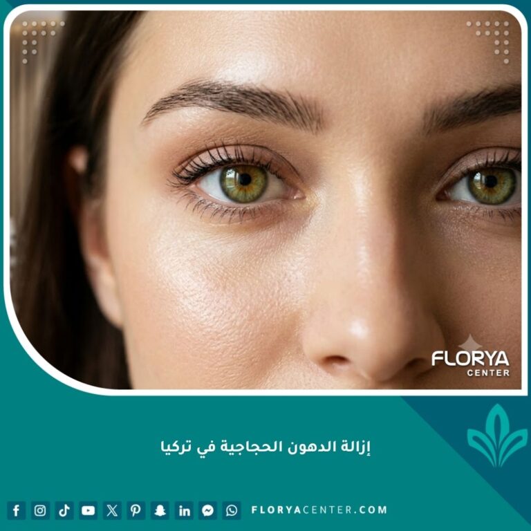 صورة مقربة تظهر جمال وشباب العينين بعد نجاح عملية إزالة الدهون الحجاجية في تركيا.