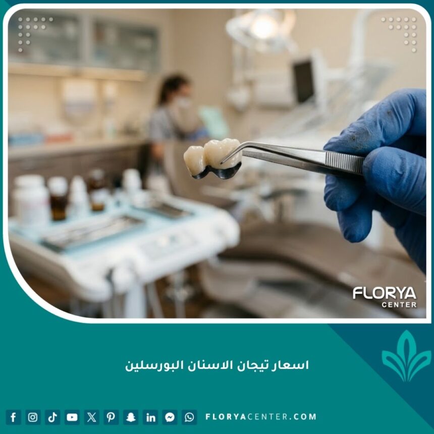 تاج أسنان بورسلين مغطى بالمعدن عالي الجودة يُظهر تفاصيل تركيبات الخزف التقليدية بأسعار مناسبة.