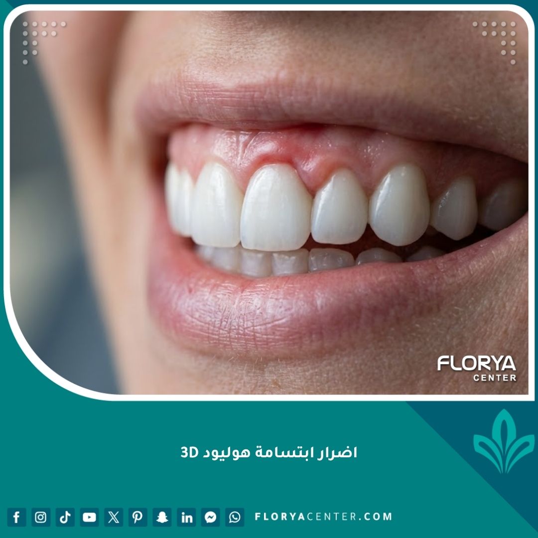 صورة مقربة لأسنان تظهر التهاب اللثة الذي يعتبر من أبرز اضرار ابتسامة هوليود 3D.