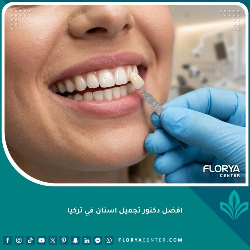 صورة مقربة لابتسامة مثالية توضح مهارة افضل دكتور تجميل اسنان في تركيا في اختيار لون وشكل الأسنان بدقة.